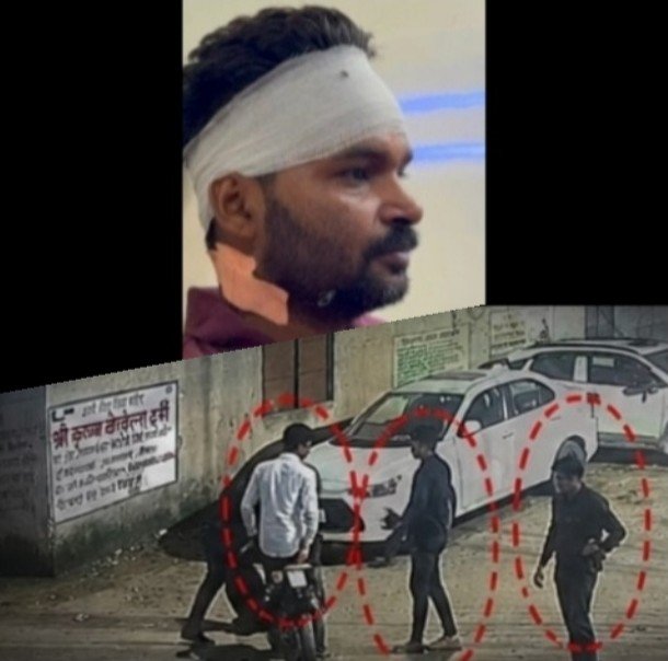 (कोरबा) ऑटो चालक पर चाकुओं से ताबड़तोड़ हमला करने का आरोप-सीसीटीवी में कैद हुई वारदात