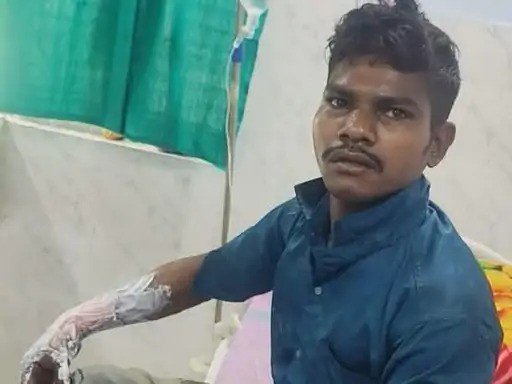 (कोरबा) पत्नी पर कमेंट करने पर मित्र को जिंदा जलाने की कोशिश का आरोप