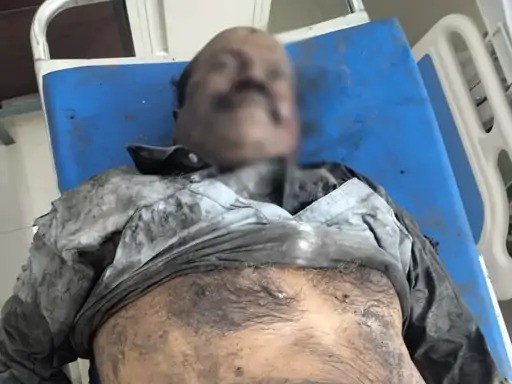 (कोरबा) घटित हादसे में कुसमुंडा खदान में कार्यरत मजदूर की मौत
