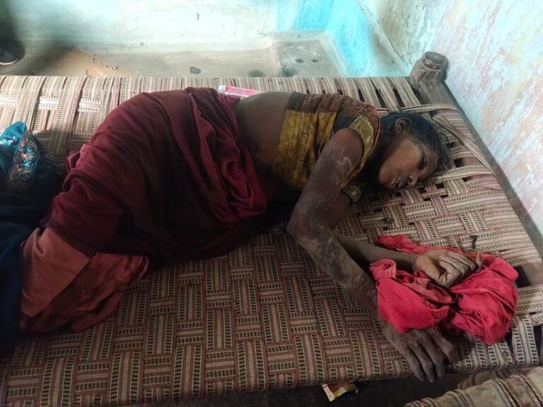 (कोरबा) बारिश से घिरे घर के नीचे दब कर आंगनबाड़ी सहायिका हुई घायल
